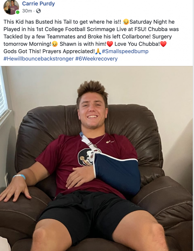 Purdy Breaks Collarbone